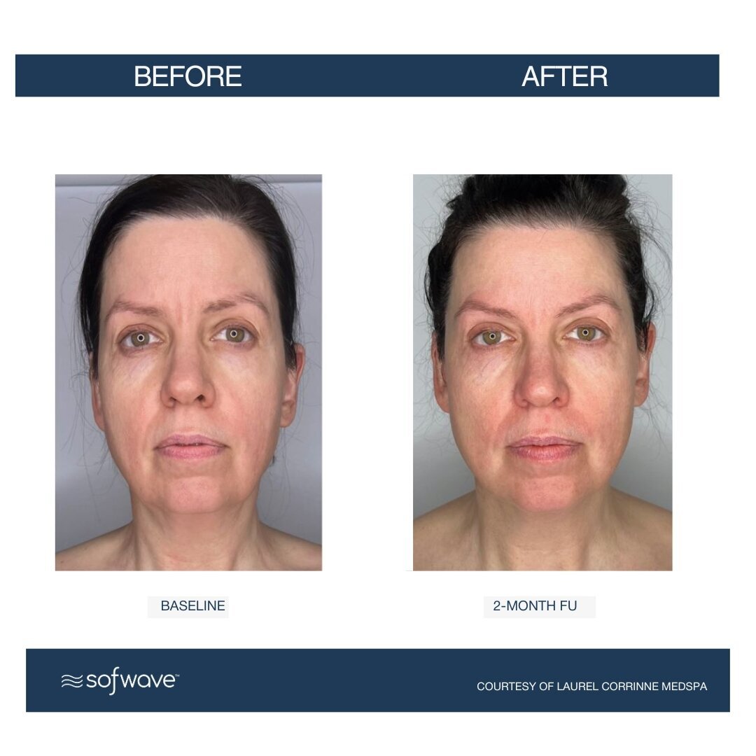 Set-70-Full-Face (1)