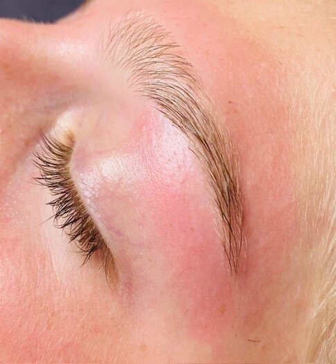 Lily After