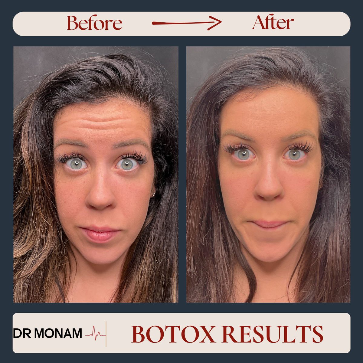 Neutral Before and After Instagram Post-6