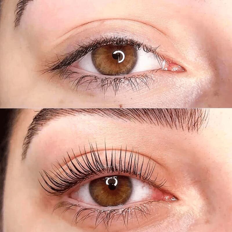 Lashlift