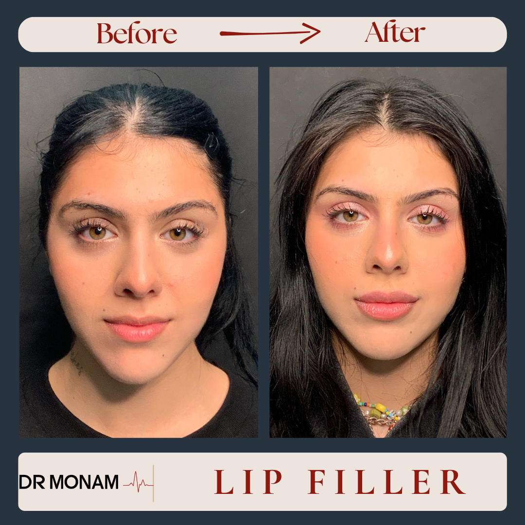 Neutral Before and After Instagram Post-15