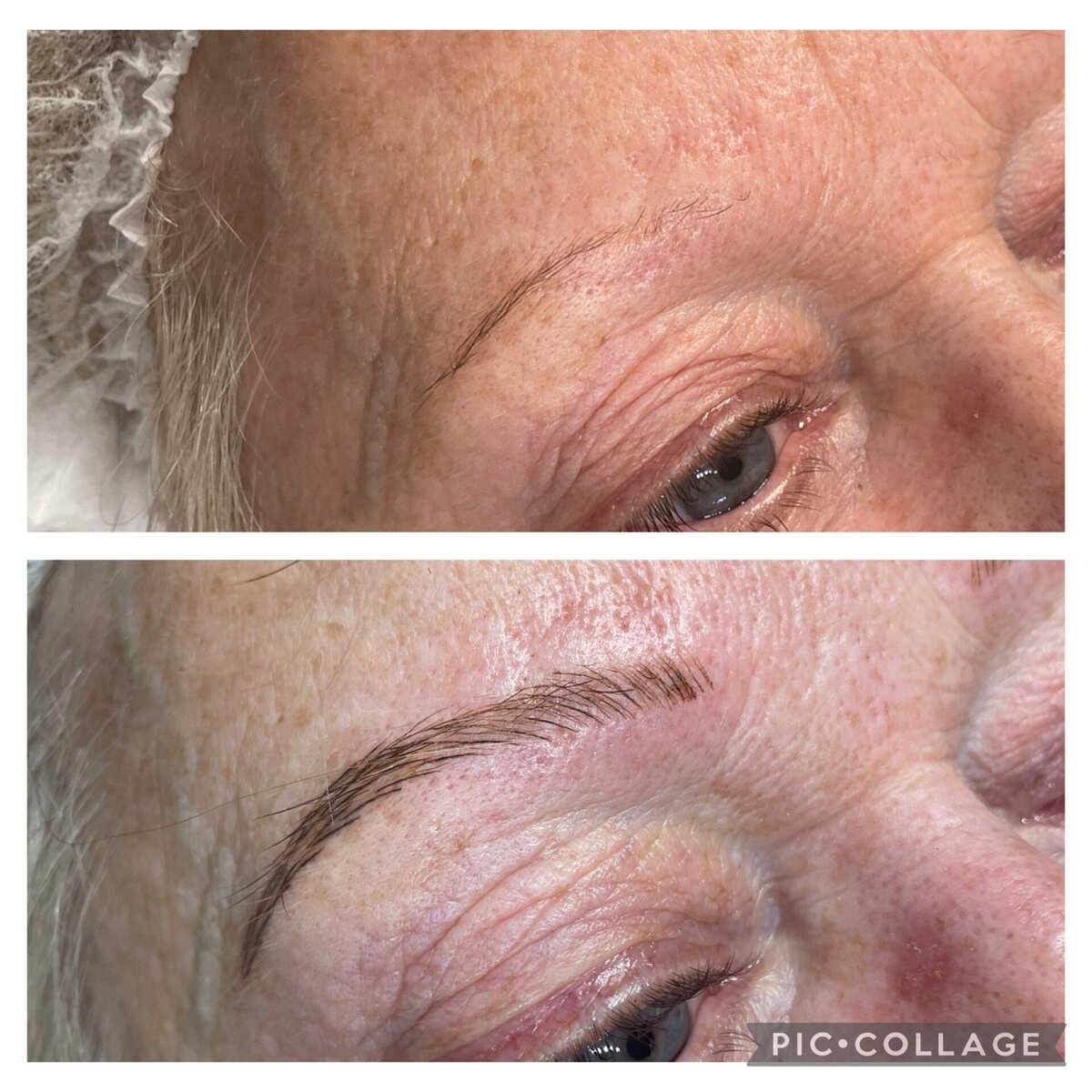 microblading in norwich based clinic aesthetic practitioner