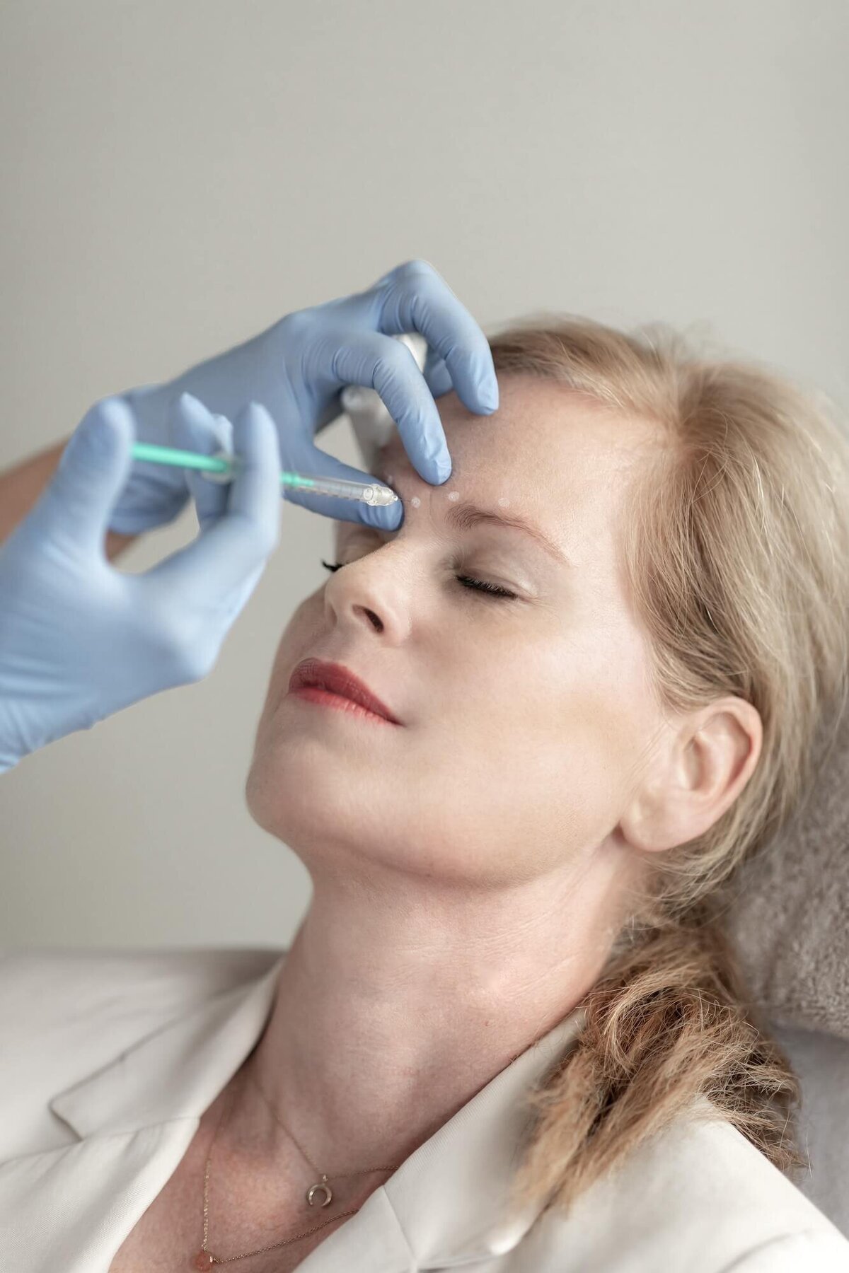 Botox door drs Lizenka Adriaanse cosmetisch arts Rotterdam