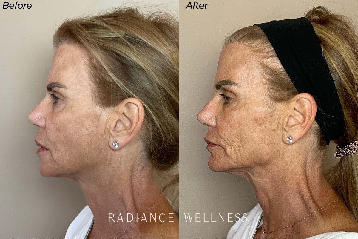 Facial-Balancing-BNA-1