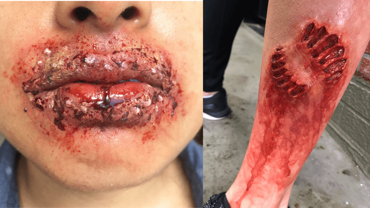 Special effects - cut lips and ripped leg - Makeup by Molly