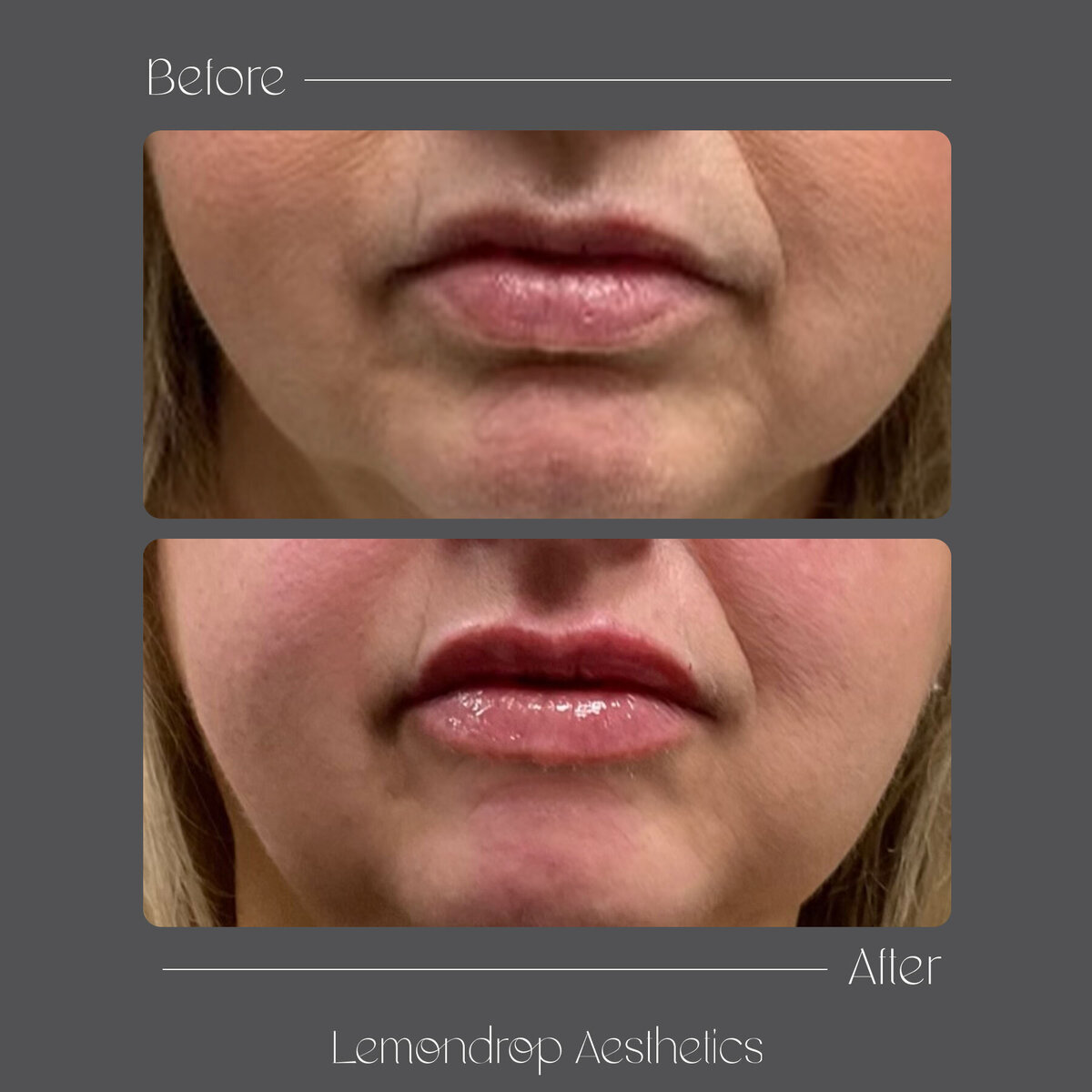 BEFORE-AFTER 2