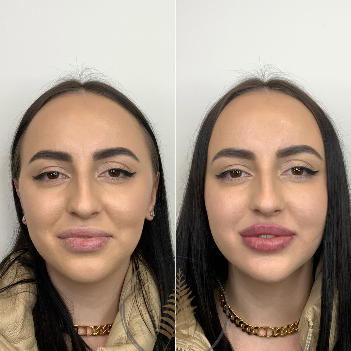 BEFORE:AFTER02 copy 21