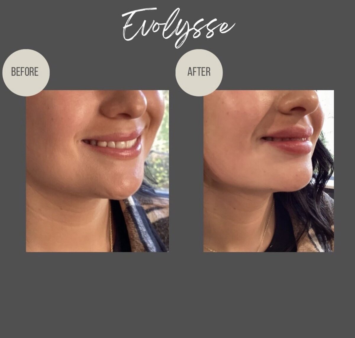 Medical Spa Brookfield, WI | Aesthetics & Weight Loss
