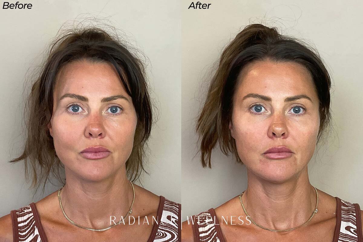 Facial-Balancing-BNA-7