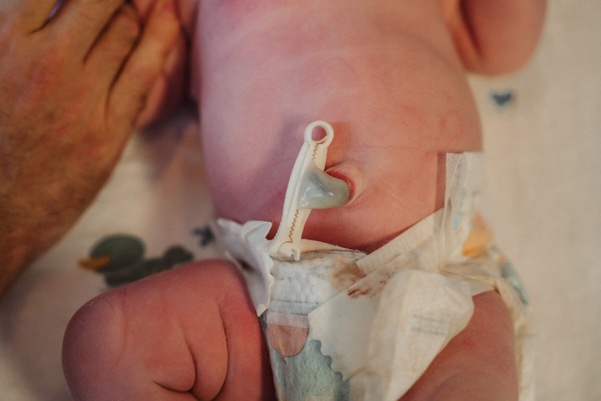 cesarean-birth-photography-natalie-broders-c-062