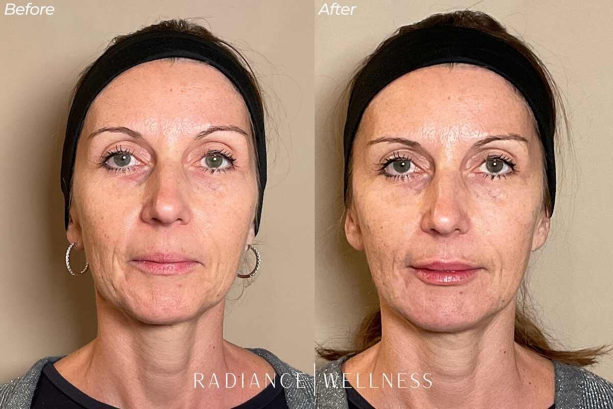 Facial-balancing-bna-nov13-1