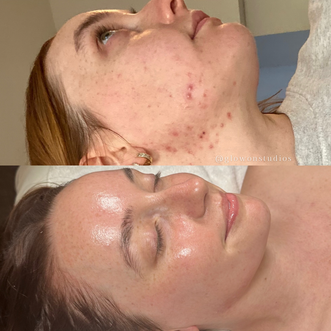 Client Before & After 1