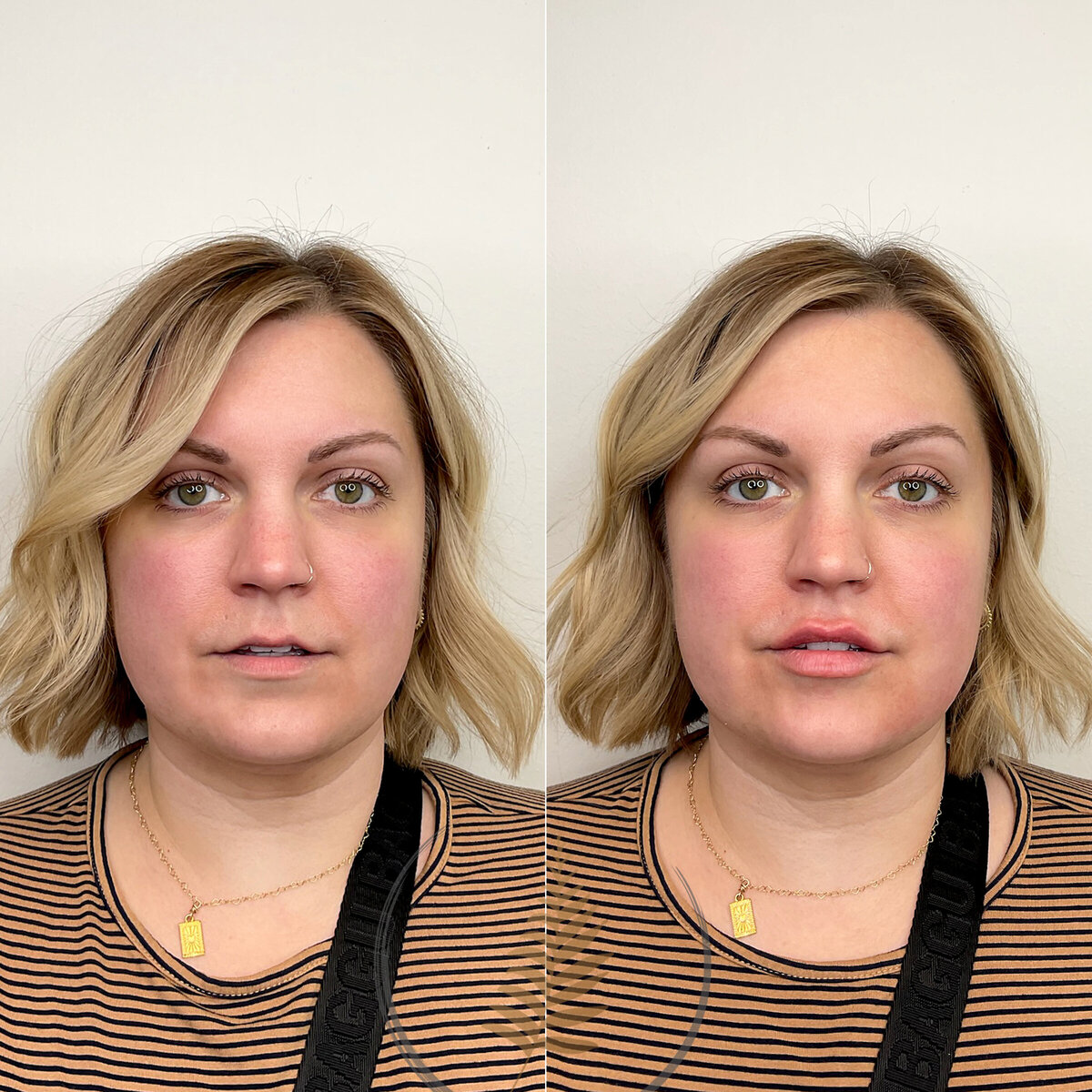 BEFORE:AFTER02 copy