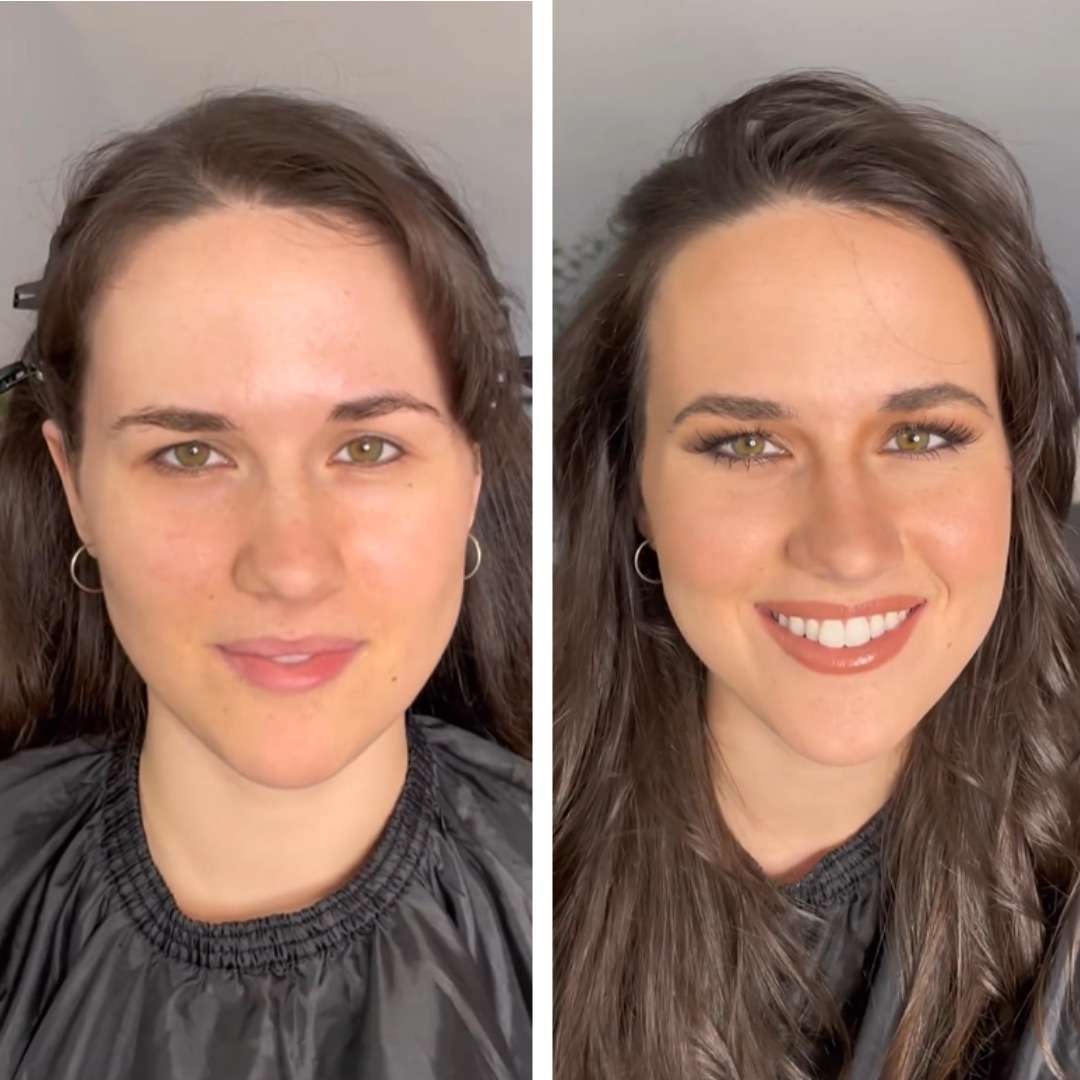 Simple Photo Before and After Skincare Instagram Post - 17