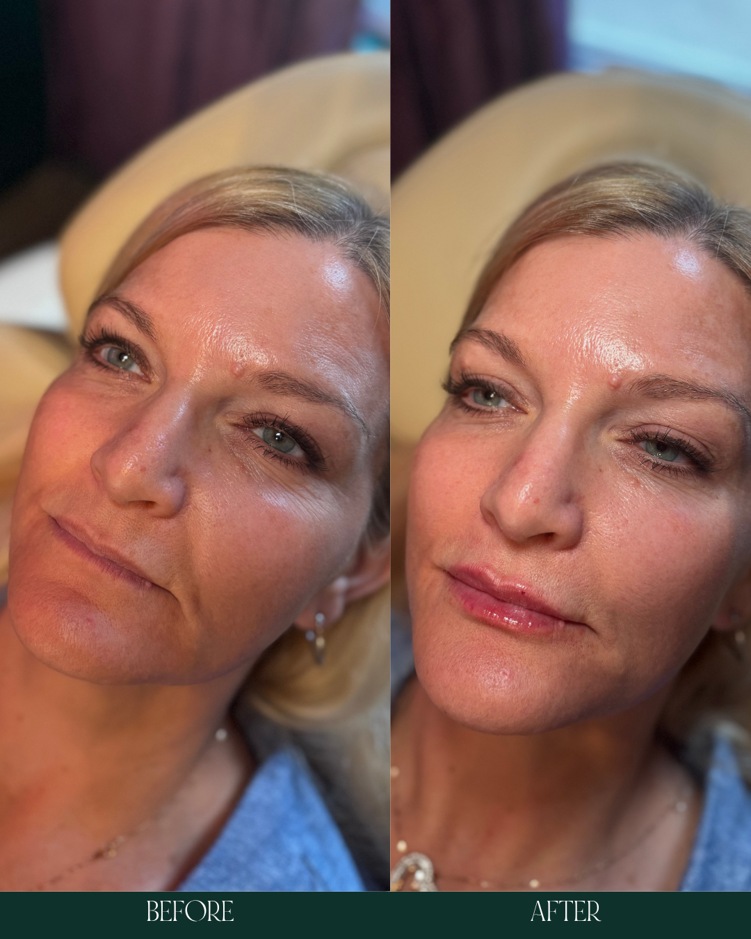 Copy of Before and Afters (Portrait Size).zip - 2