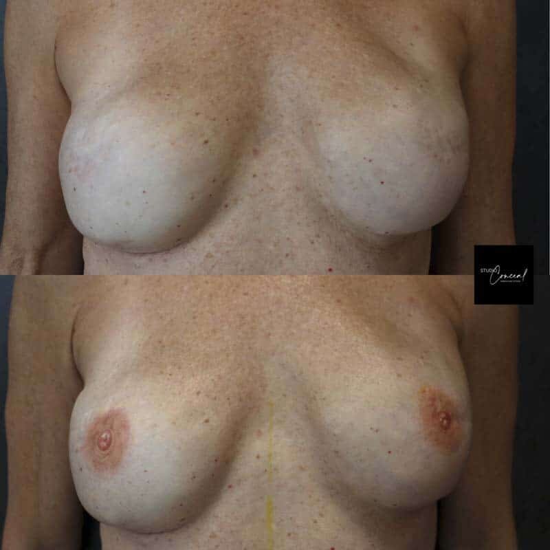az-mastectomy-tattoo-artist