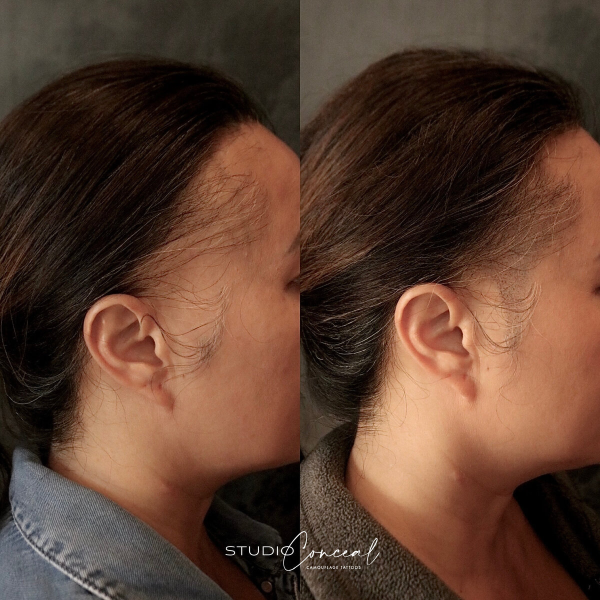alopecia-hair-tattoo-arizona