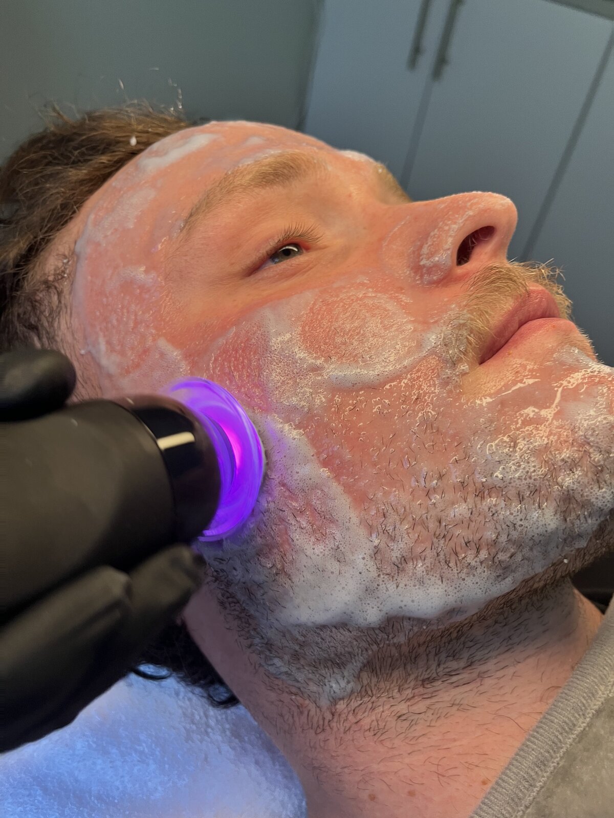 male glo2 facial client