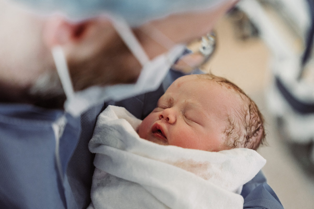 cesarean-birth-photography-natalie-broders-c-036