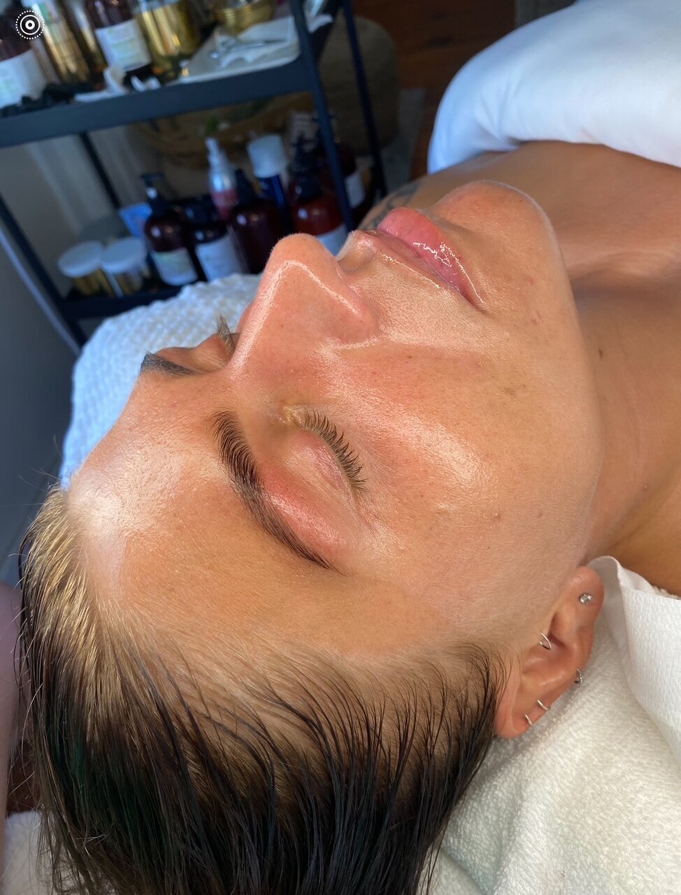 Brow Results