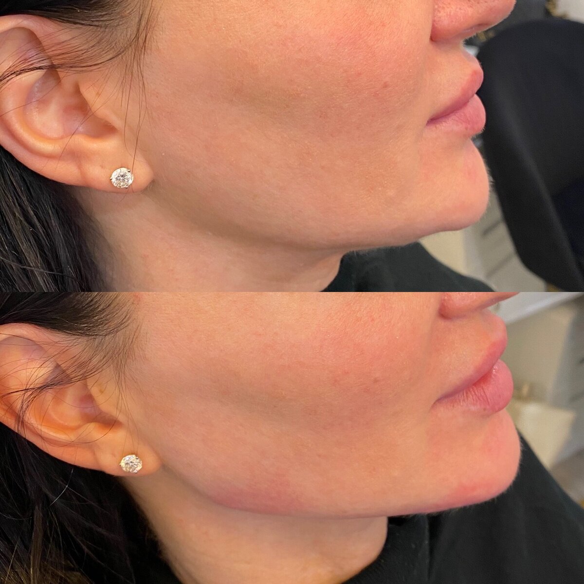 BalancedBeautyBotoxWestwood13