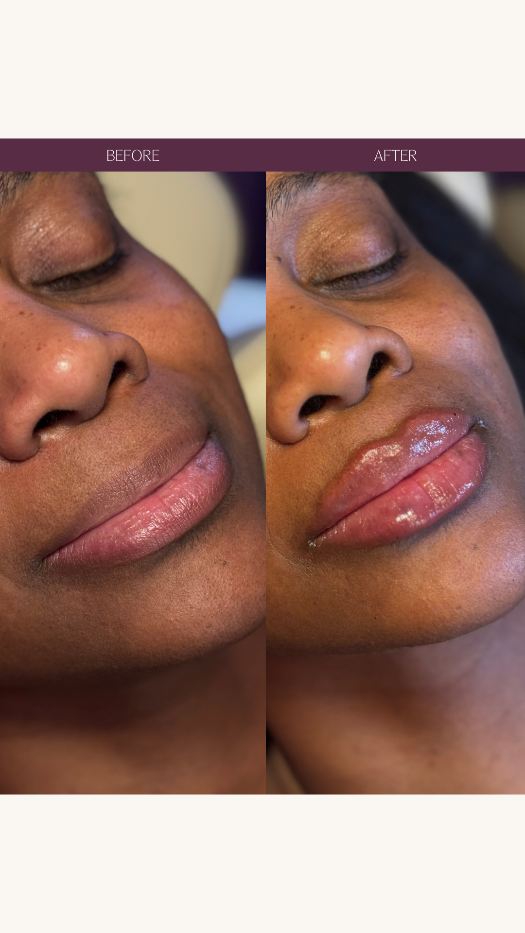 Copy of Before and Afters (Portrait Size).png 3