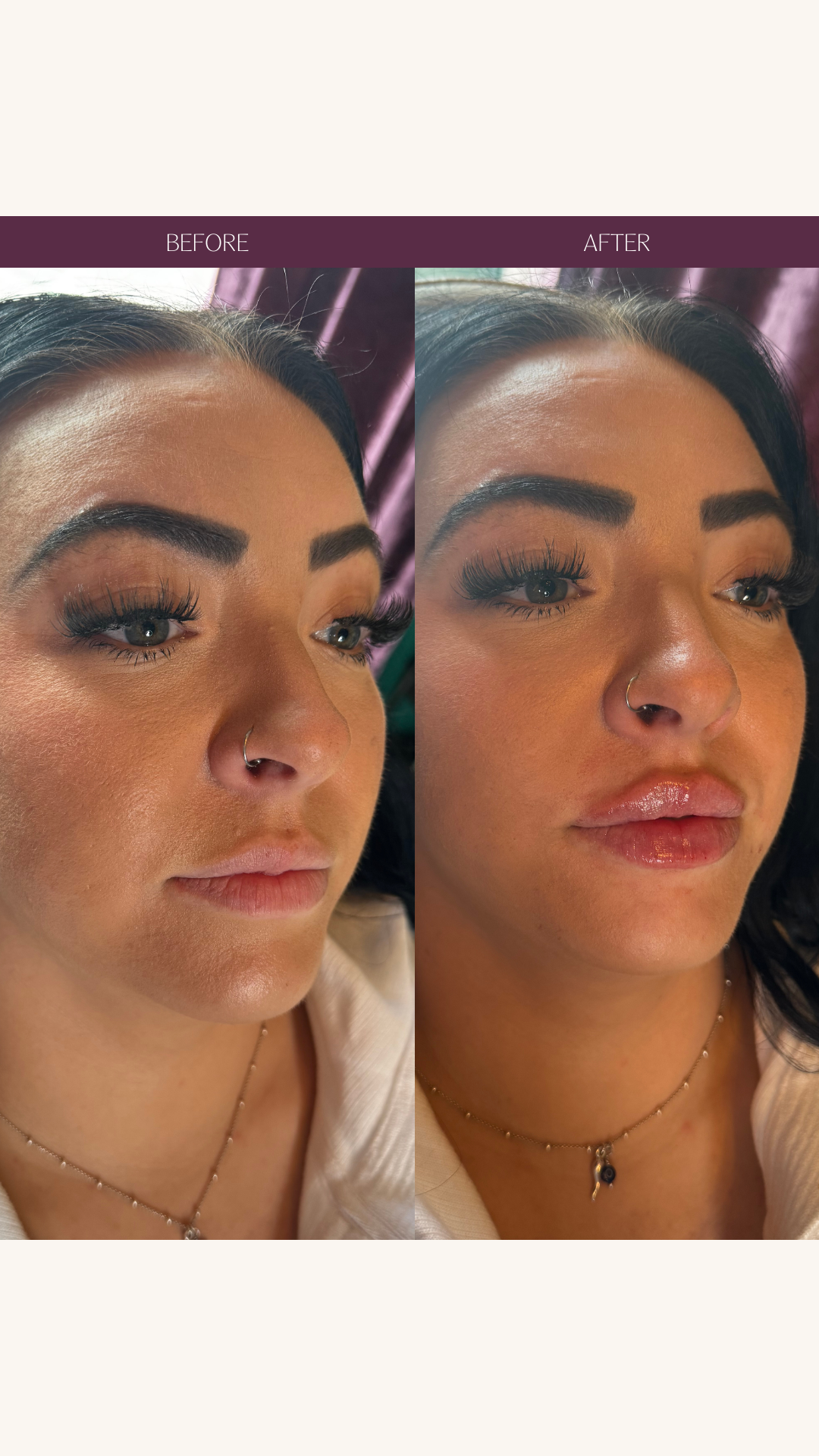 Copy of Before and Afters (Portrait Size).png 9