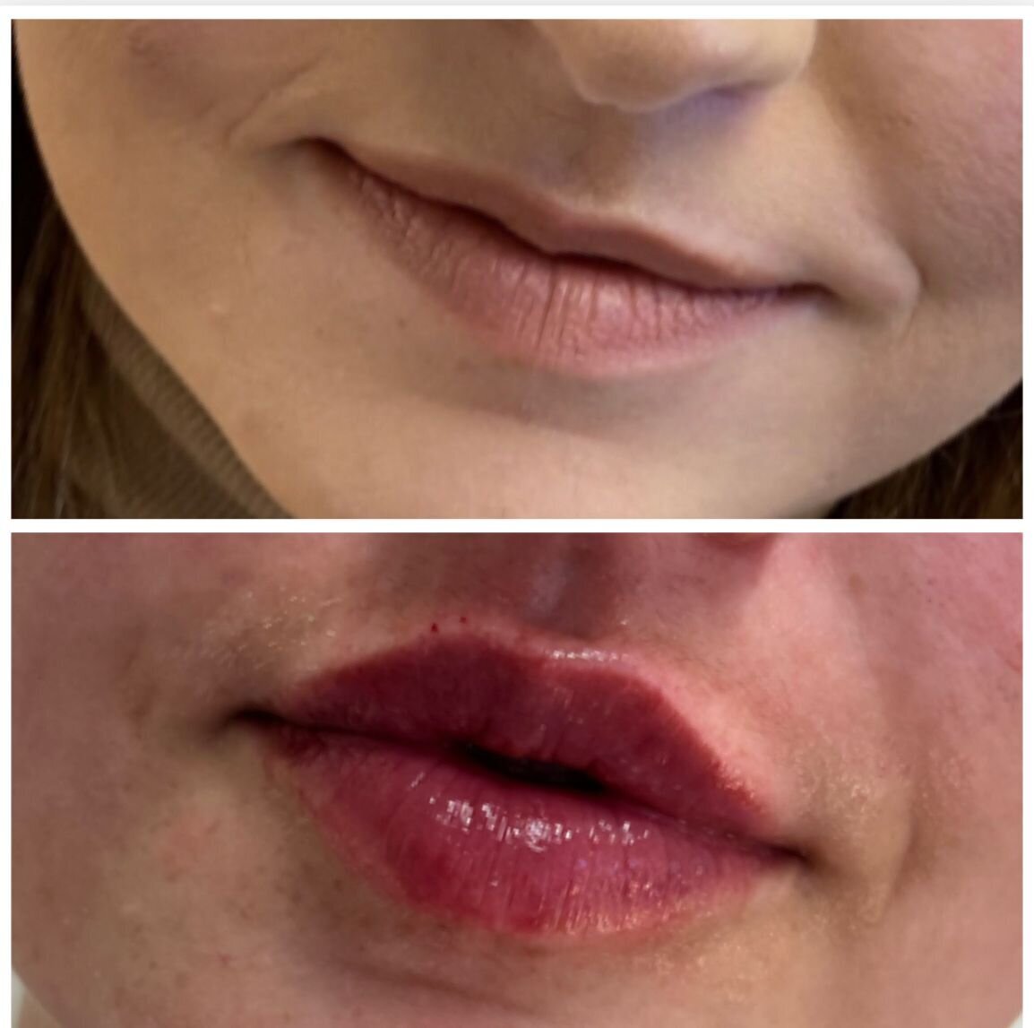 compressed-Lip-Wrinkles- Lip-volume-nd-some-brand-pics-26