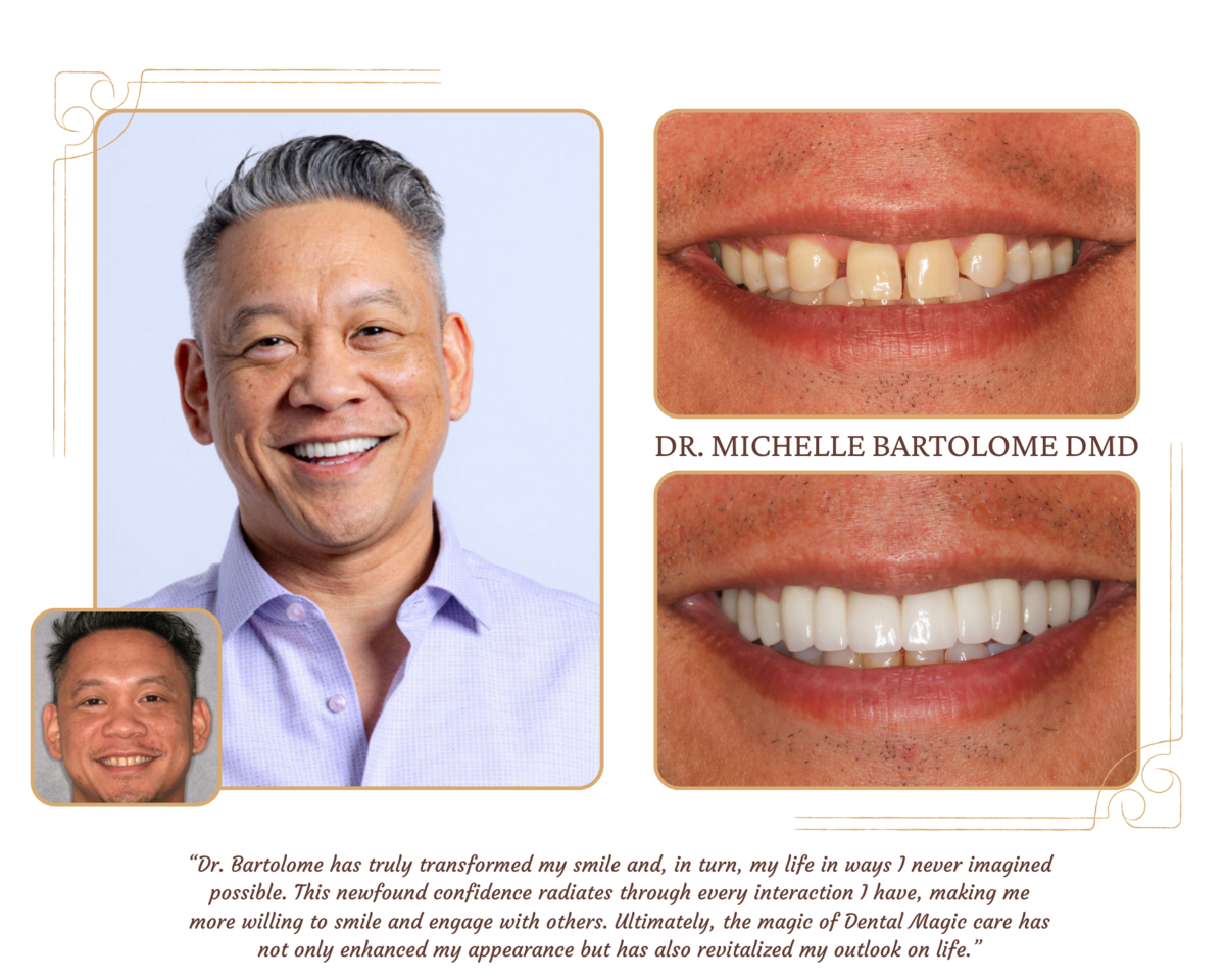 Smile Makeover (2)