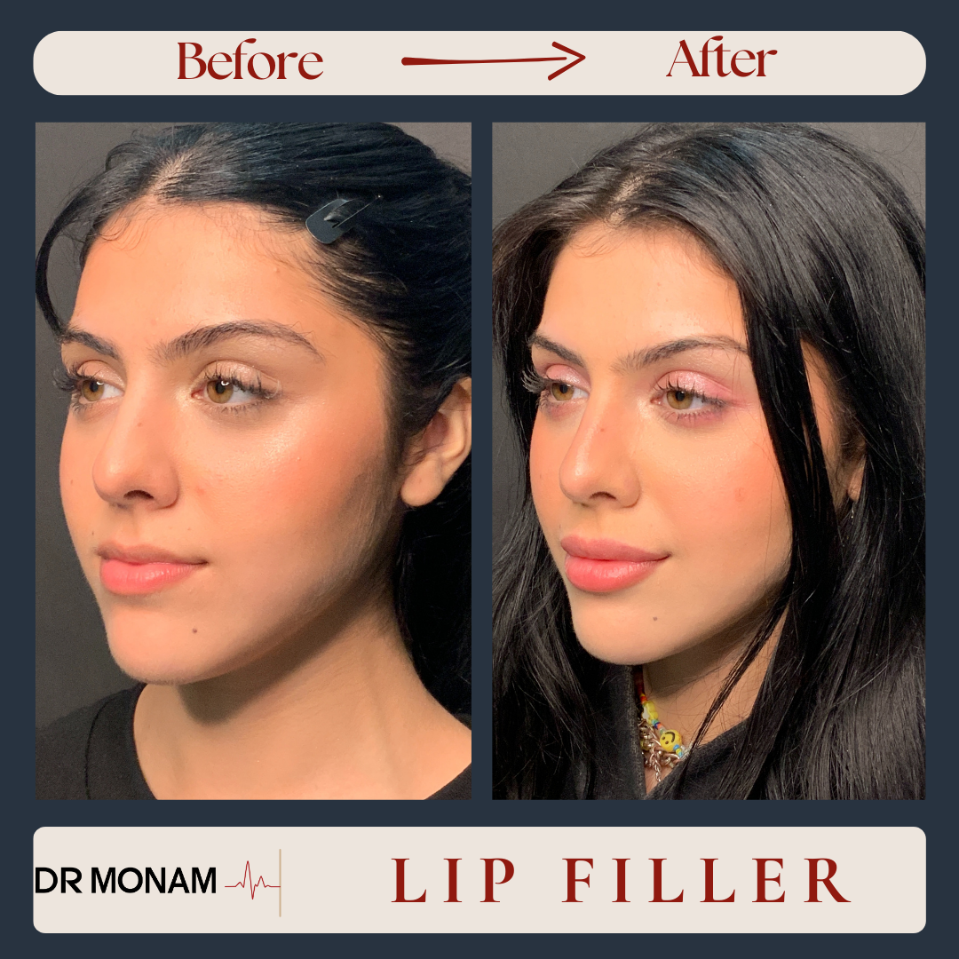 Neutral Before and After Instagram Post-16