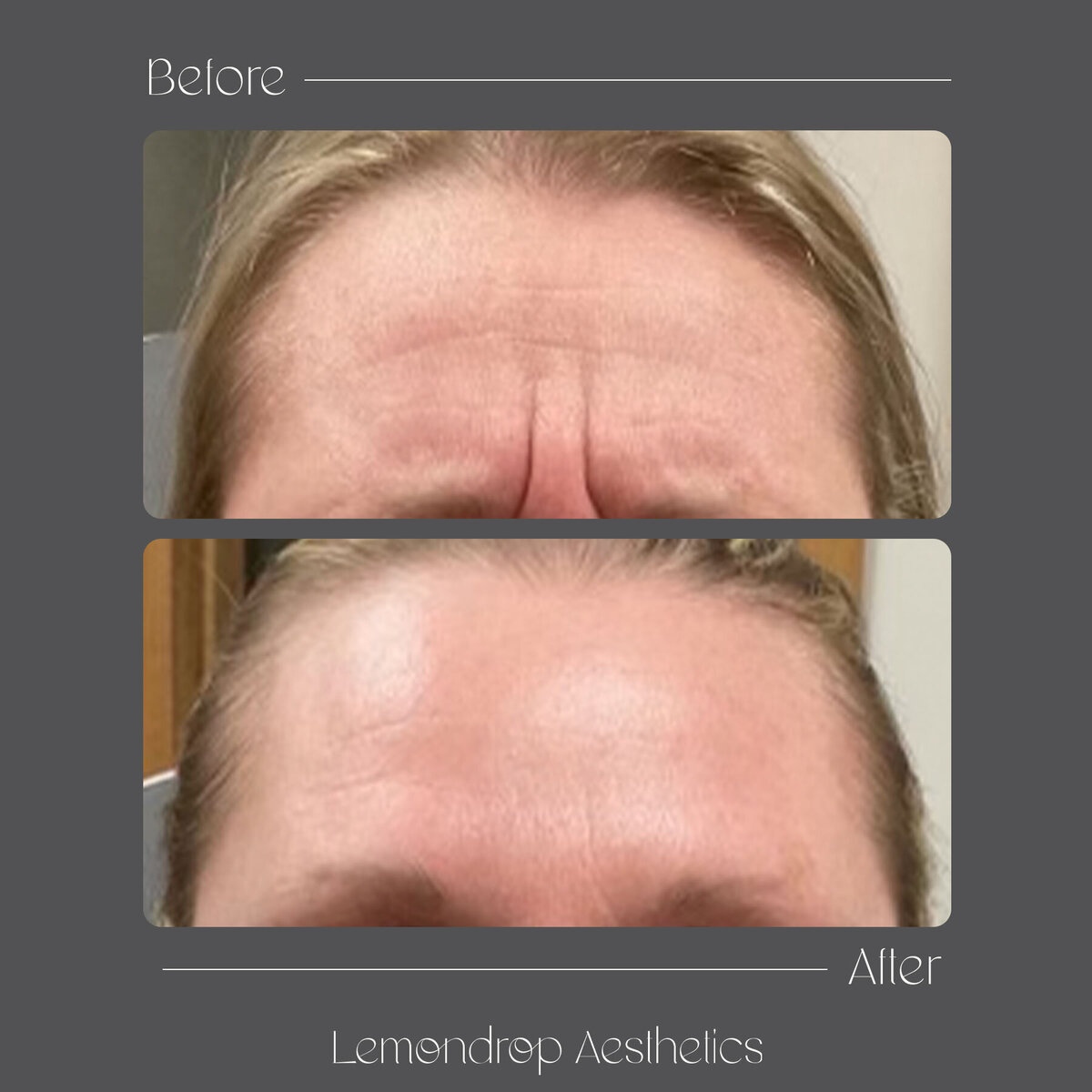 BEFORE-AFTER 3