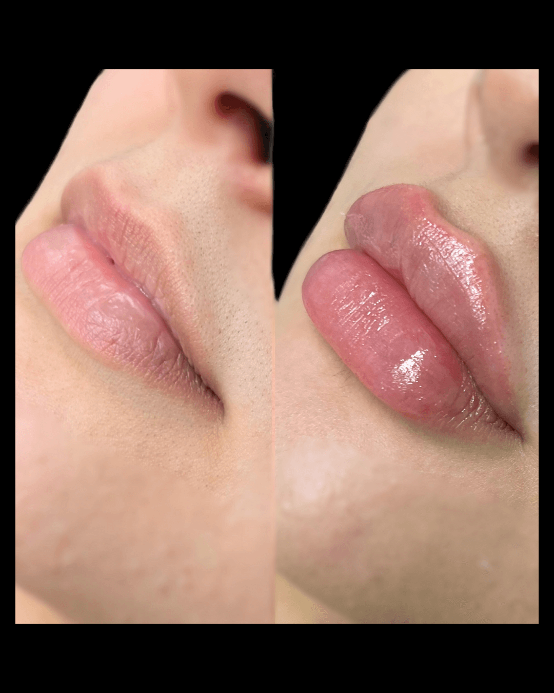 Maxwell-Aesthetics-Salem-Oregon-Results-3