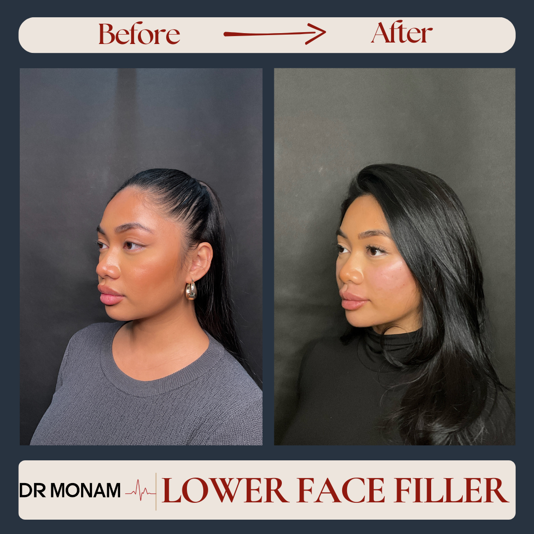 Neutral Before and After Instagram Post-19