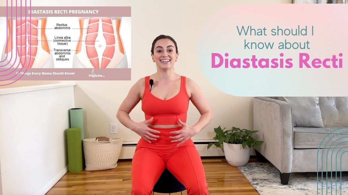 diastasis  Large