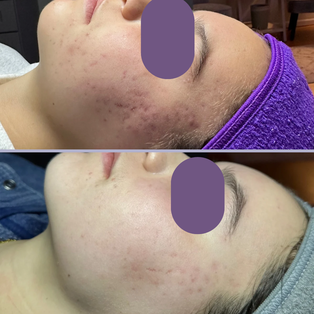 Isabel A B&A - 2