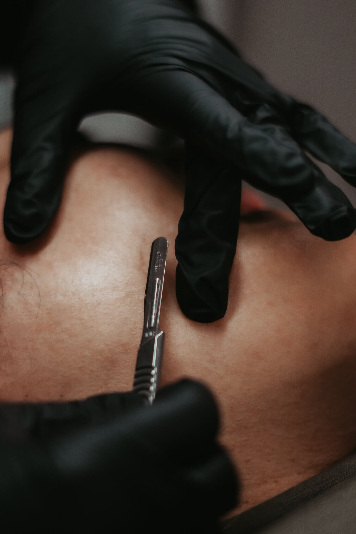 image of hands doing a dermaplane facial on a client at Stephanie Schuh Beauty.