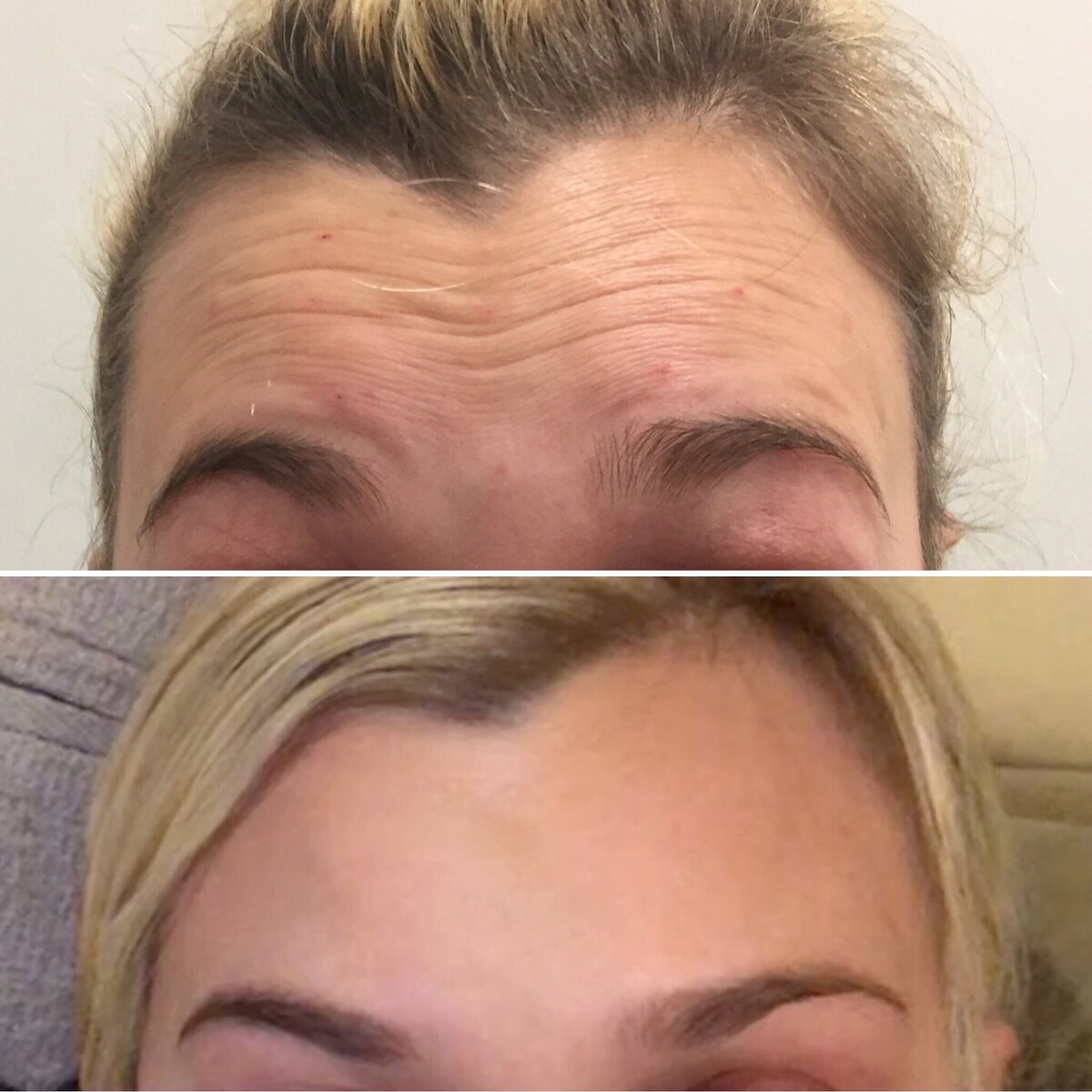 BalancedBeautyBotoxWestwood4