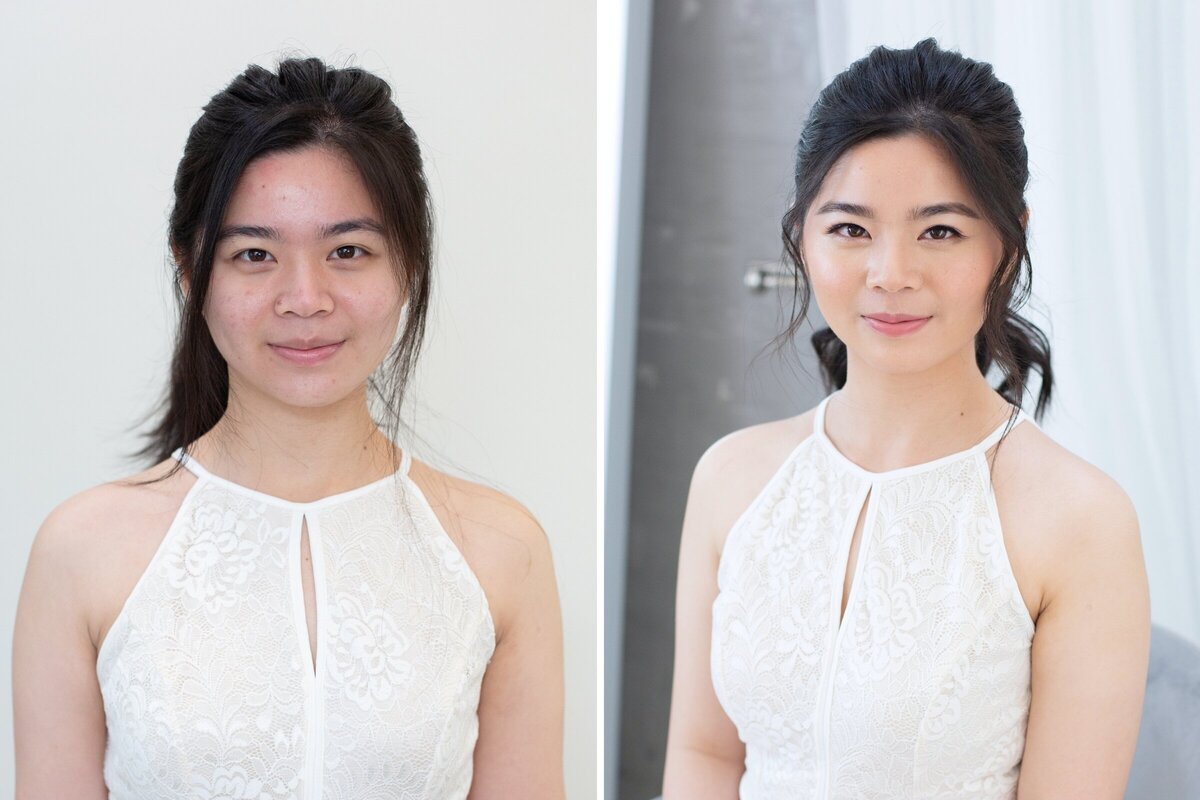 O Wai Before After