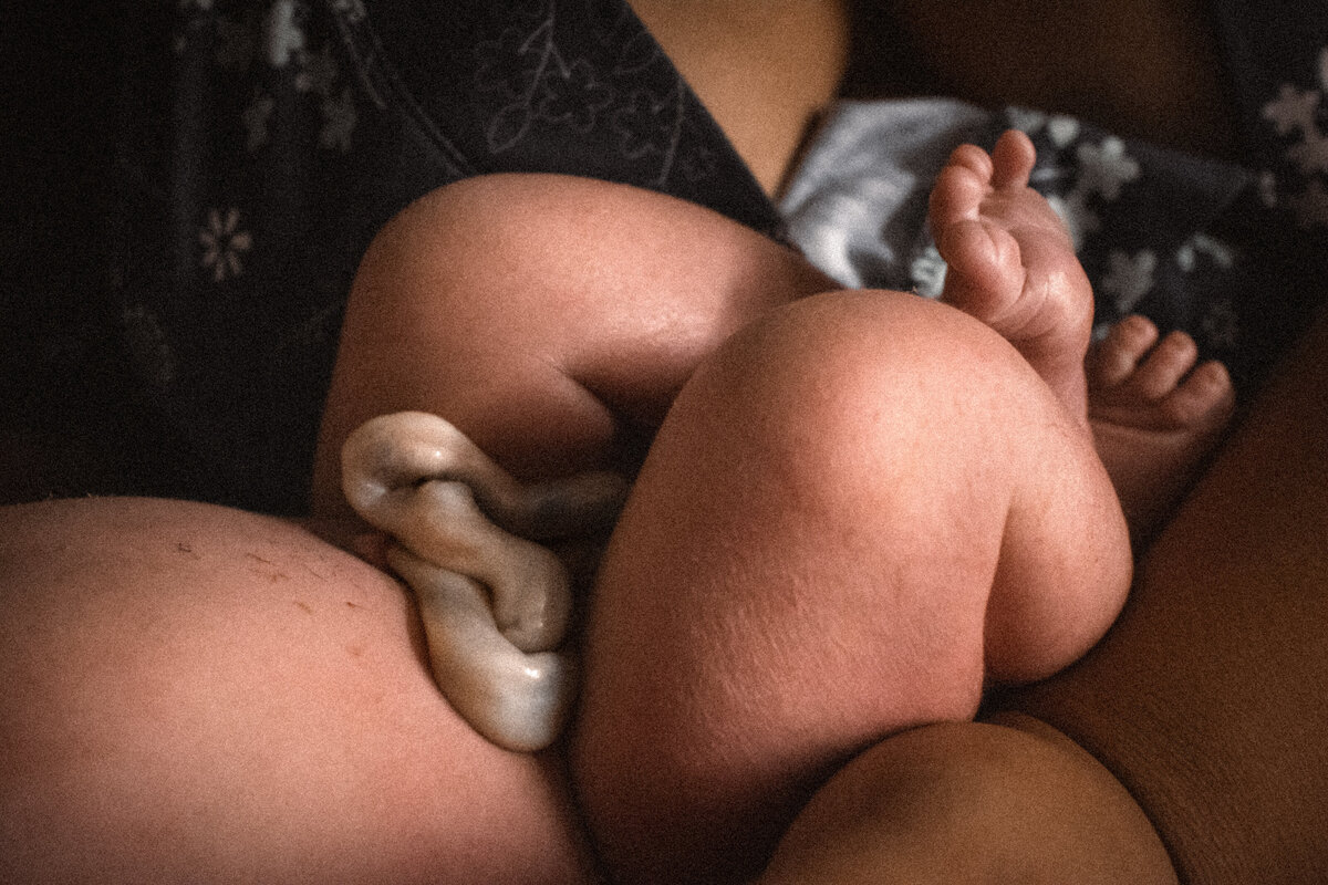 Newborn baby legs umbilical cord