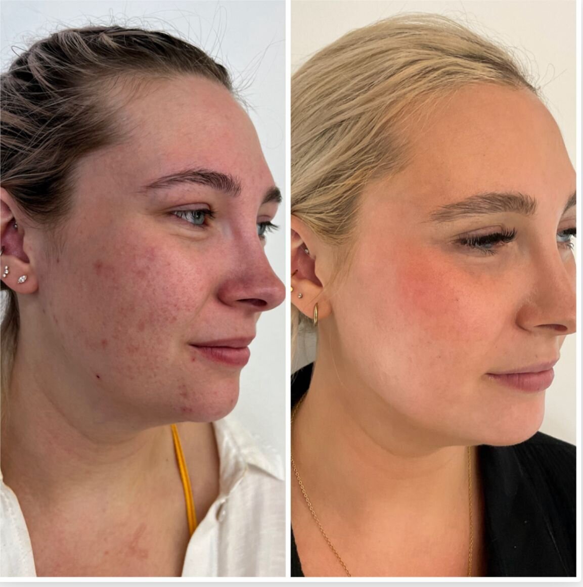 compressed-halo-before-after-09