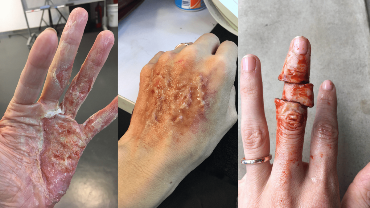 Special effects skin irritation and severed body parts - Makeup by Molly-min