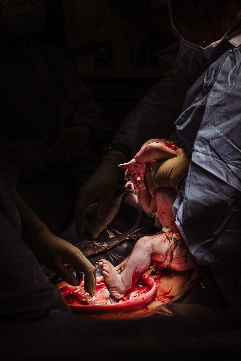 cesarean-birth-photography-natalie-broders-d-078