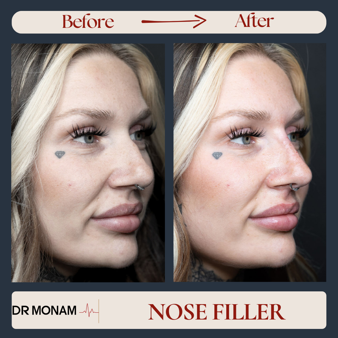 Neutral Before and After Instagram Post-10