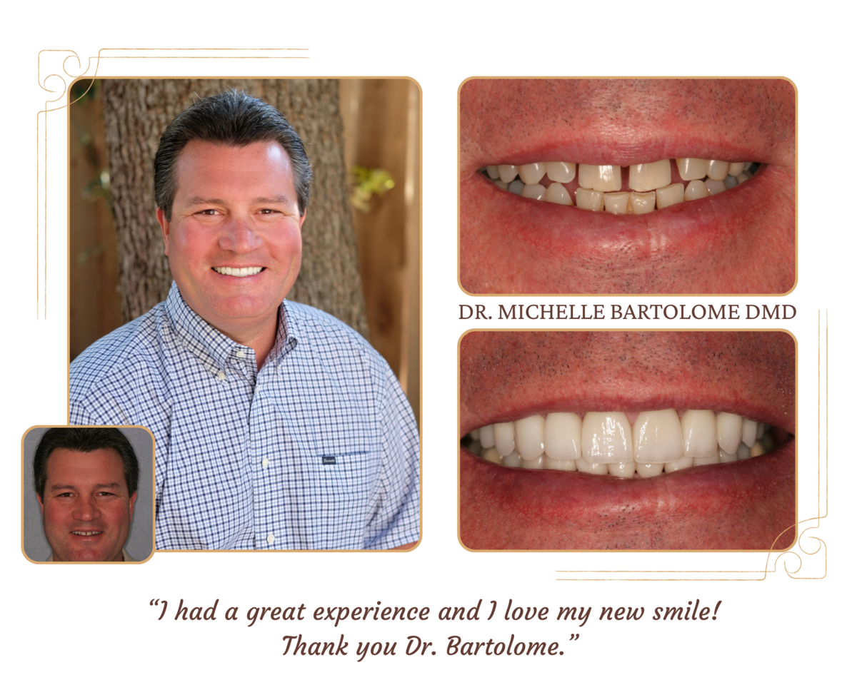 Smile Makeover (8)