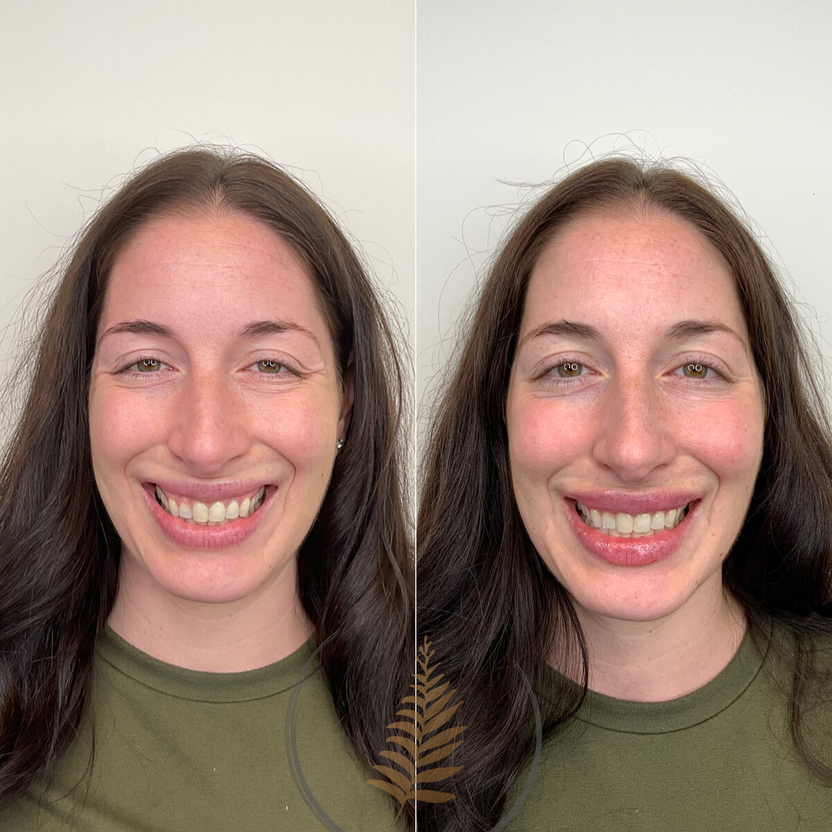 BEFORE:AFTER02 copy 7