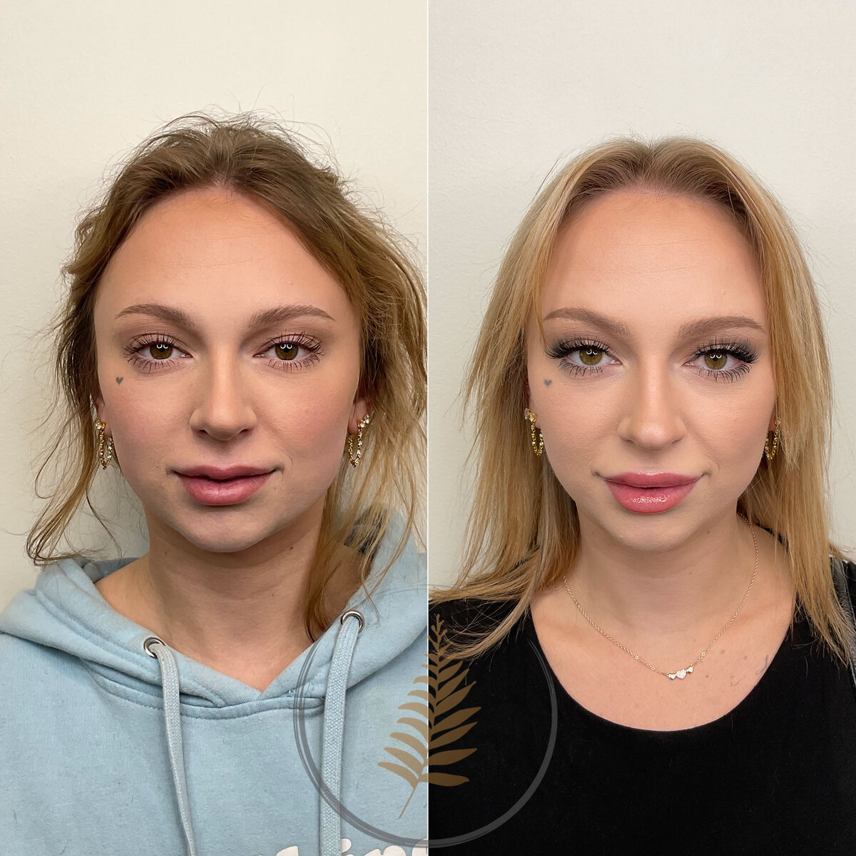BEFORE-AFTER01 copy 8