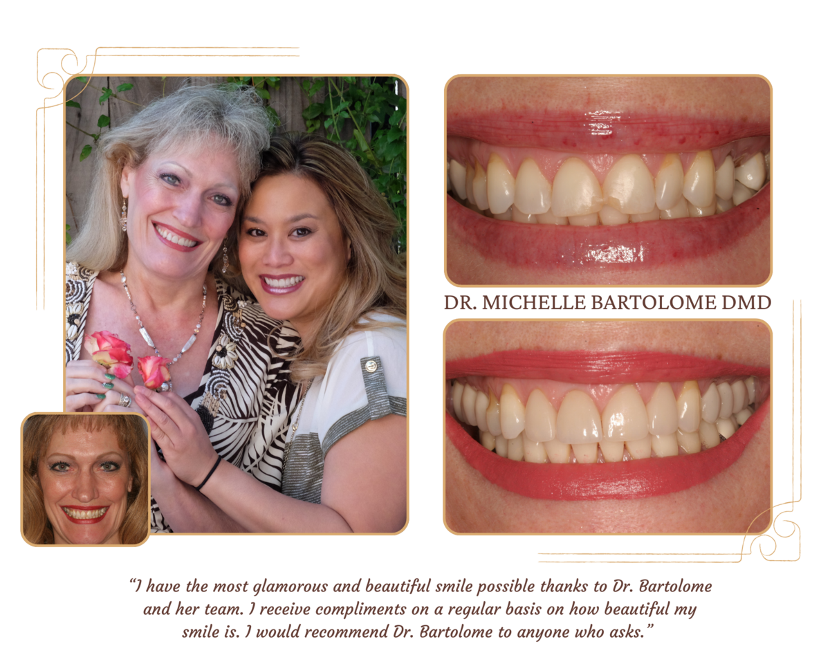 Smile Makeover (6)