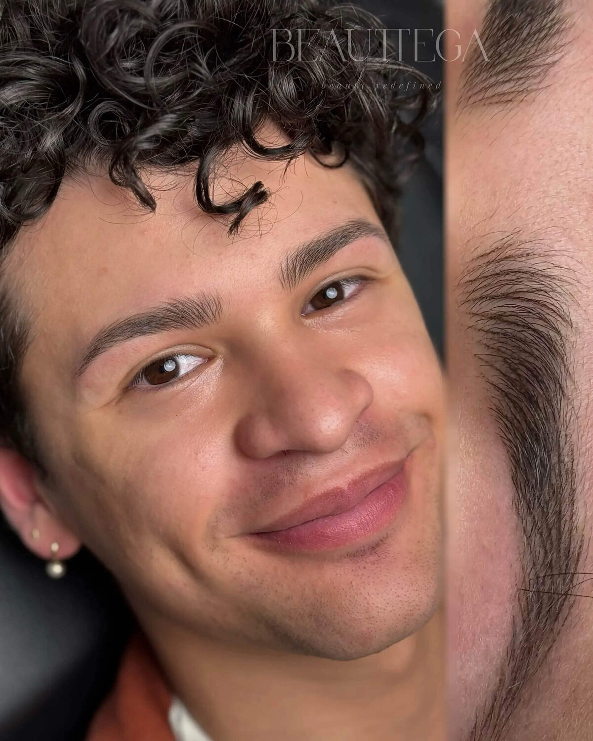 Beauttega C Nano Machine Hair Strokes 40 (C+R)