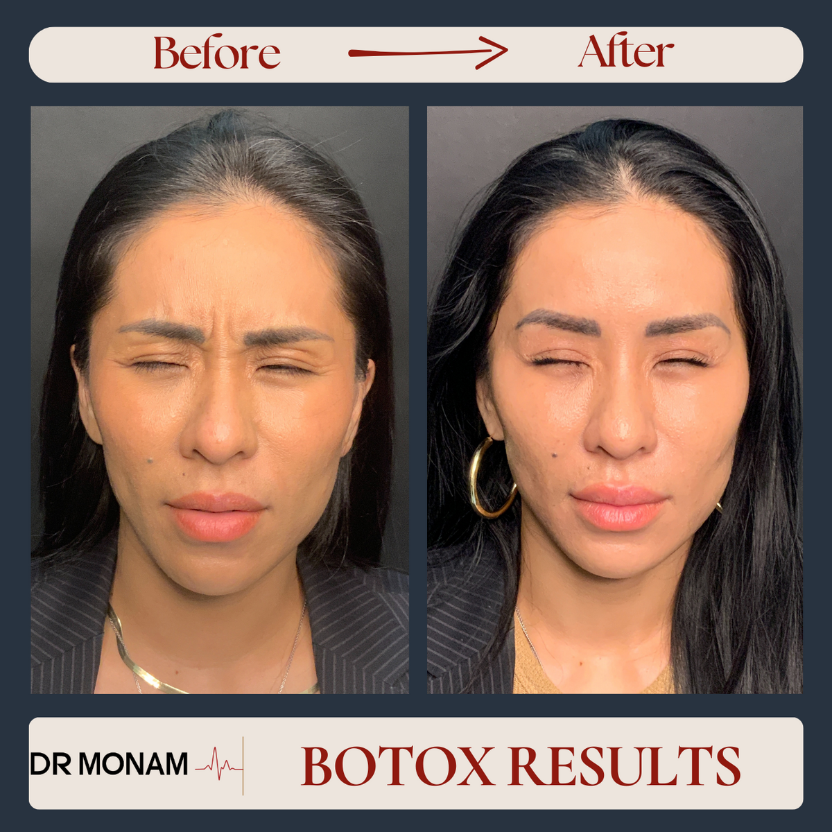 Neutral Before and After Instagram Post-4