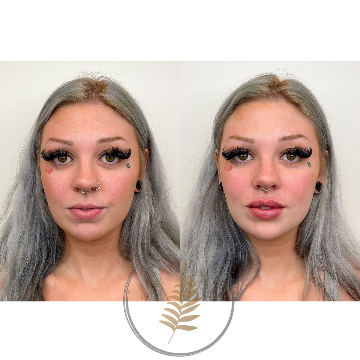 FACESINBLOOM_BEFOREAFTER_LIPS_12